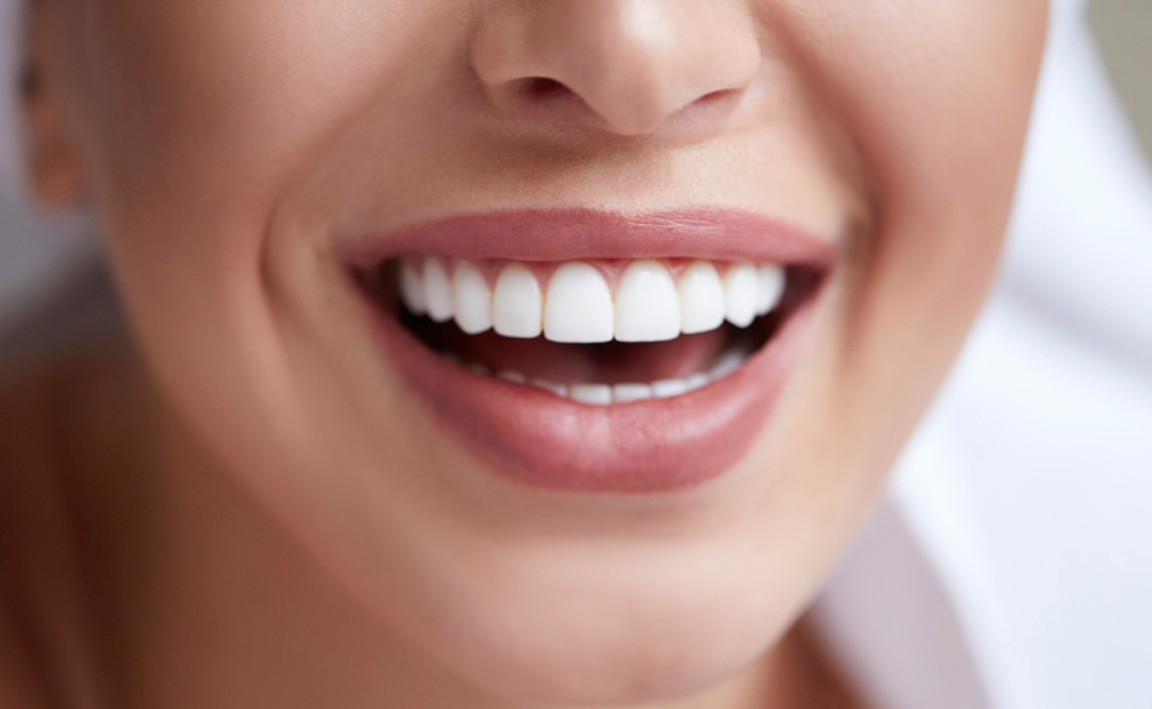 Aesthetic/Esthetic Dentistry